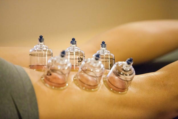 Short Term Benefits And High Satisfaction Of Moving Cupping Therapy To